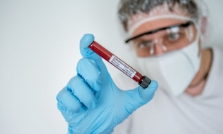 INSP a actualizat definiţiile de caz şi recomandările de prioritizare a testării prin RT-PCR pentru Covid-19
  